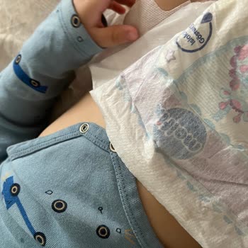 Molfix Diapers Suddenly Caused Diaper Rash on My Baby After Long-Term Use