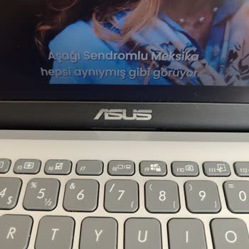 Tabii Uygulamasında Anlamsız Alt Yazı Sorunu