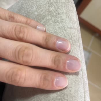 Gizem Erduran Beauty Aldığım Hizmetten Sonra Parmaklarımı Kullanamıyorum