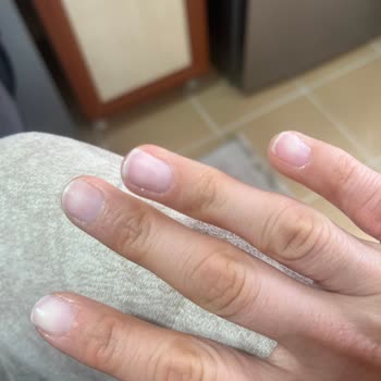 Gizem Erduran Beauty Aldığım Hizmetten Sonra Parmaklarımı Kullanamıyorum