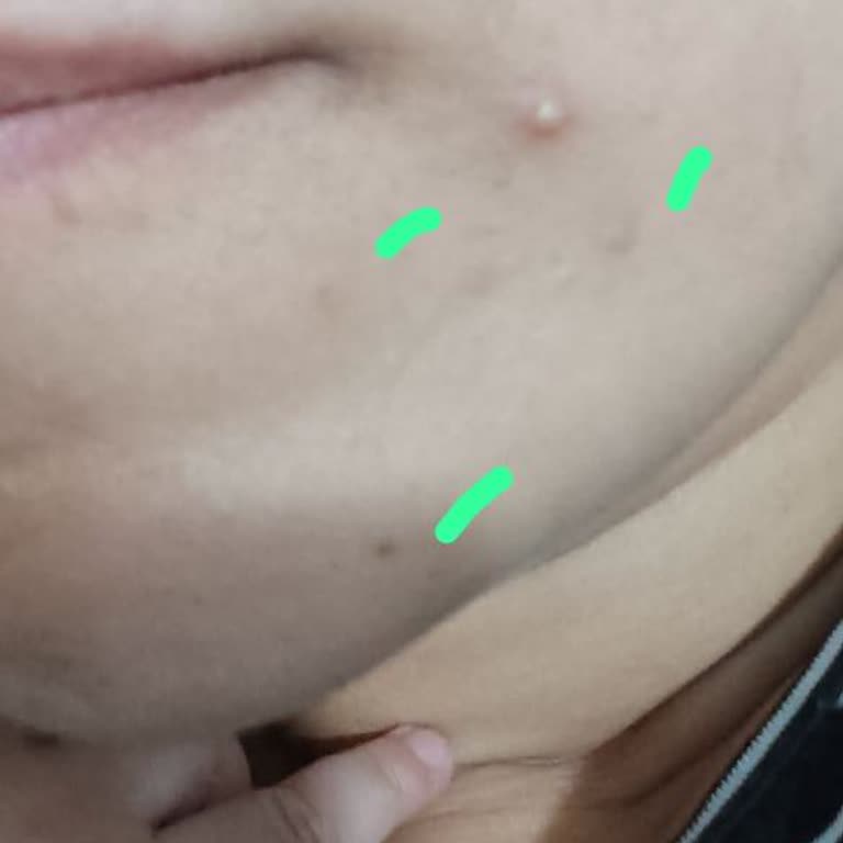 Güzellik Merkezinde Hayal Kırıklığı Ve İletişim Sorunları