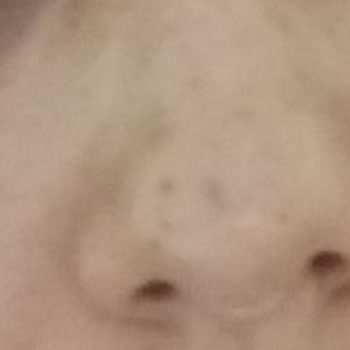 Zeynep Mir Beauty Yanıltıcı Tedavi Ve İlgisizlik