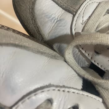 Adidas Samba Ayakkabıda Beklenmedik Kalite Sorunları: Renk Atması Ve Taban Kayması