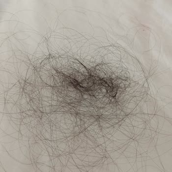 Kerastase Ürünleri Saç Dökülmesini Arttırdı!