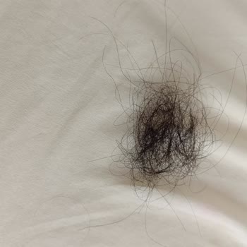 Kerastase Ürünleri Saç Dökülmesini Arttırdı!