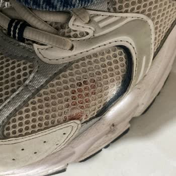 New Balance 530 Model Ayakkabıda Kronik Sorun