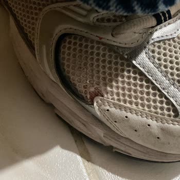 New Balance 530 Model Ayakkabıda Kronik Sorun