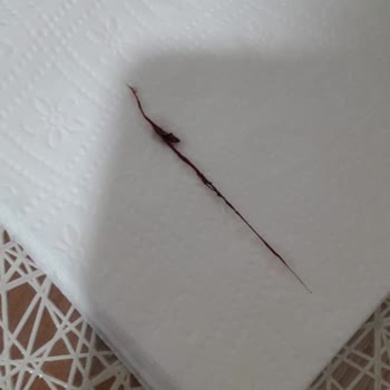 Cappy Vişne Suyunda Sağlık Tehlikesi