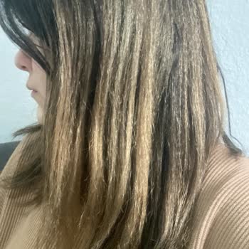 Yanlış Uygulama Sonucu Saçlarım Yandı Ve Maddi Kayıp Yaşadım