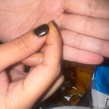 Ruffles Cipsin İçinden Çıkan Yabancı Madde Şoku