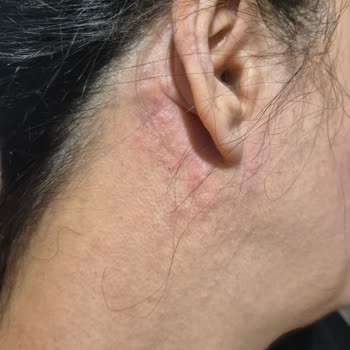 Alerji Yapan Ürünle İlgili Acil Yardım Talebi