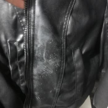 Bershka Ceketinde Kalıcı Parfüm Lekesi Ve Soyulma Sorunu