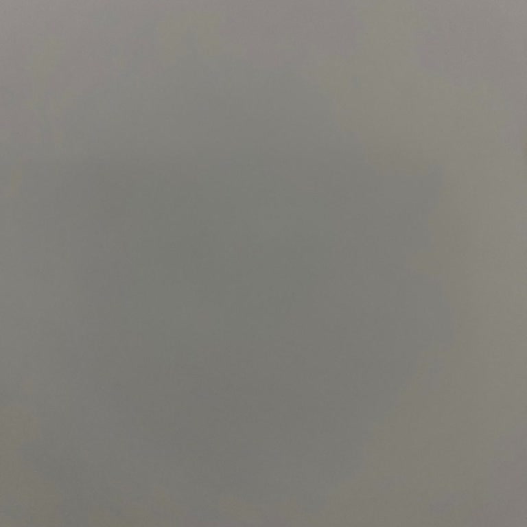 Synevo Alerji Testinde Hayal Kırıklığı Ve Güven Sorunu