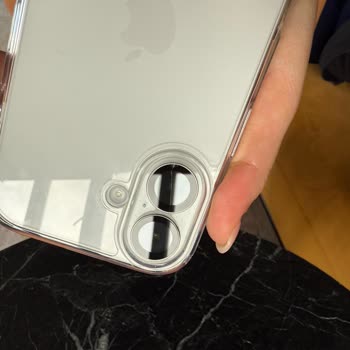 Teknosa Kalitesiz Lens Ve Yetersiz Müşteri Hizmeti