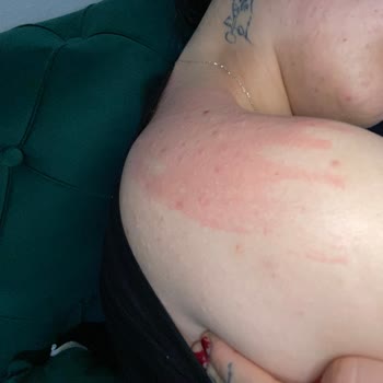 Ürün Alerji Yaptı Ve Sağlık Sorunlarına Yol Açtı