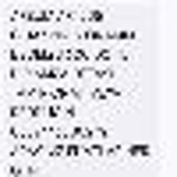 Arzum Süpürge Batarya Sorunu Ve Garanti Hayal Kırıklığı