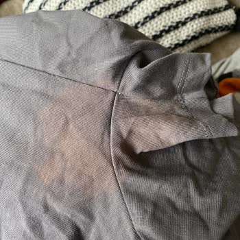 Tişörtte Renk Deformasyonu Şikayeti