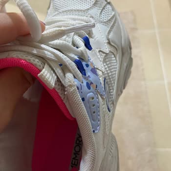 Skechers Ayakkabıda Erken Aşınma Ve Müşteri Hizmetleri Hayal Kırıklığı