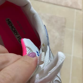 Skechers Ayakkabıda Erken Aşınma Ve Müşteri Hizmetleri Hayal Kırıklığı