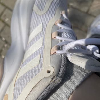 Adidas Ayakkabıda Beklenmedik Kusurlar Ve Hayal Kırıklığı