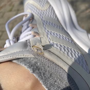 Adidas Ayakkabıda Beklenmedik Kusurlar Ve Hayal Kırıklığı