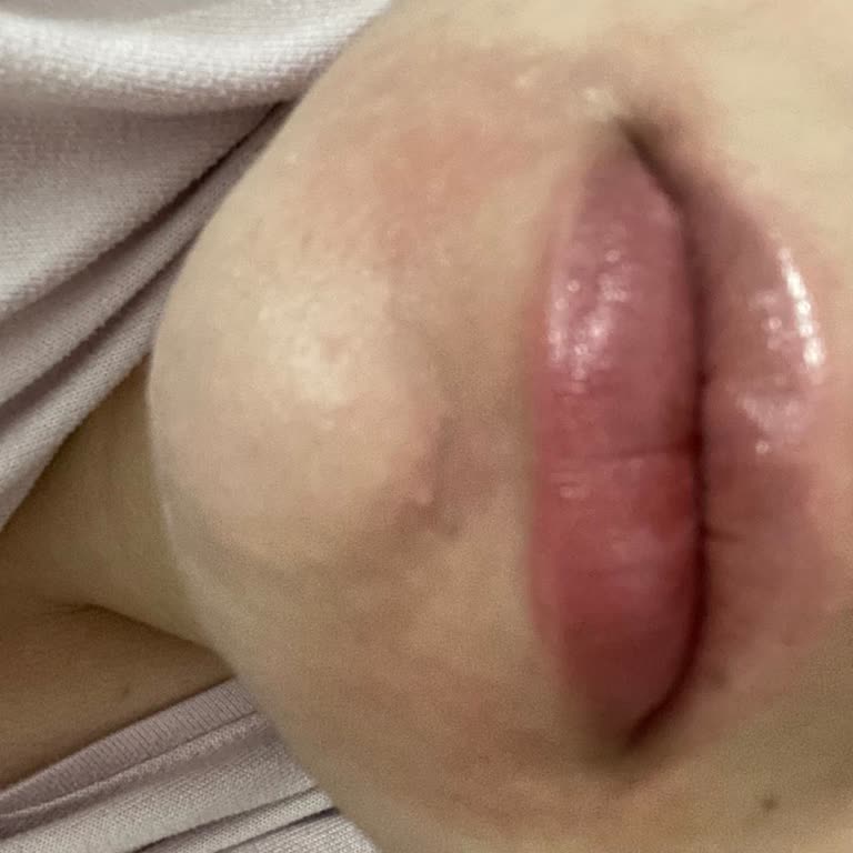 La Roche-Posay Effaclar Gel вызвал кожные реакции