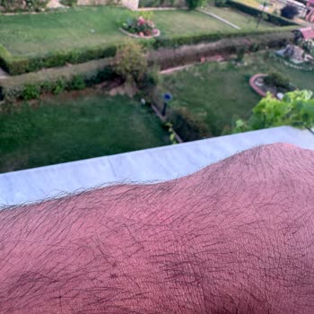 Watch 4 Kullanımı Sonrası Cilt Sorunları