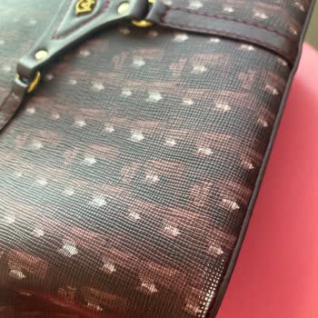 Manc Çantasında Deri Problemi Ve Uzun İnceleme Süreci