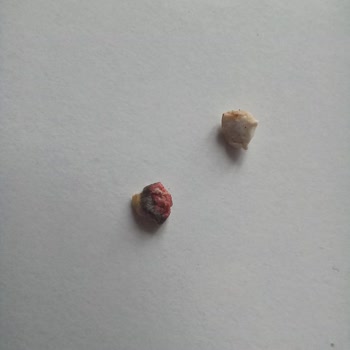 Ton Balığında Taş Şoku: Sağlık Tehlikesi