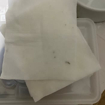 Ebebek Baby Me Pamuklarında Siyah Lekeler Ve Hayal Kırıklığı!