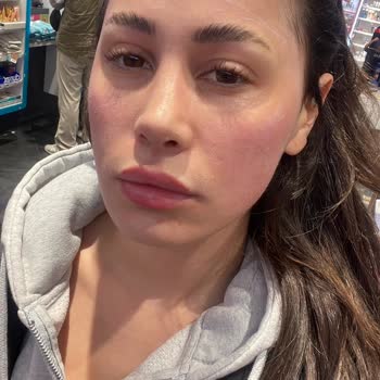 Pure Beauty BB Krem Alerji Ve Müşteri Hizmetleri Sorunu