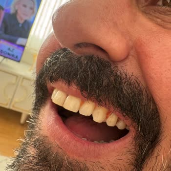 Asel Kebap 2 Gebze/Kocaeli Lahmacunun Birinin İçinden Akıllı Vida Çıktı!