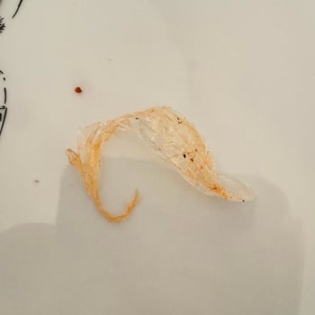 Dürümle Siparişte Bulunan Yabancı Cisim: Sağlık Tehlikesi