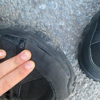 Skechers Ayakkabıda Kalite Sorunu Ve Garanti Süreci