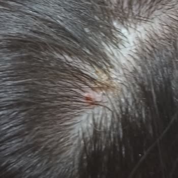 Önerilen Ürün Saçlarımda Kepek Ve Tahrişe Neden Oldu