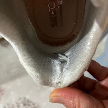 Skechers Ayakkabıda Erken Eskime Ve Garanti Sorunu