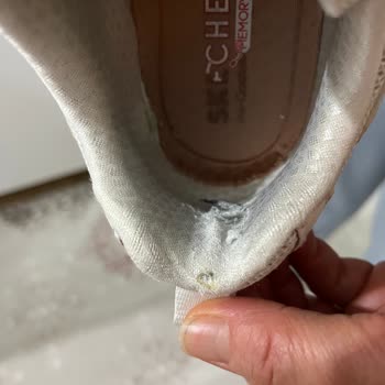 Skechers Ayakkabıda Erken Eskime Ve Garanti Sorunu