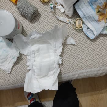 Sleepy Bezlerde Kopan Yapışkan Kulaklar Can Sıkıyor