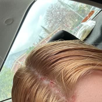 Saç Boyası Kabusu: Palette 10.1 İle Gelen Acı