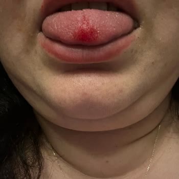 Suflede Tehlikeli Madde: Çocuklarımın Güvenliği Tehlikede
