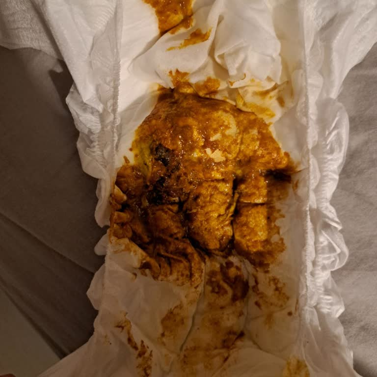 Ambalaj Değişikliği Sonrası Mama Sorunu