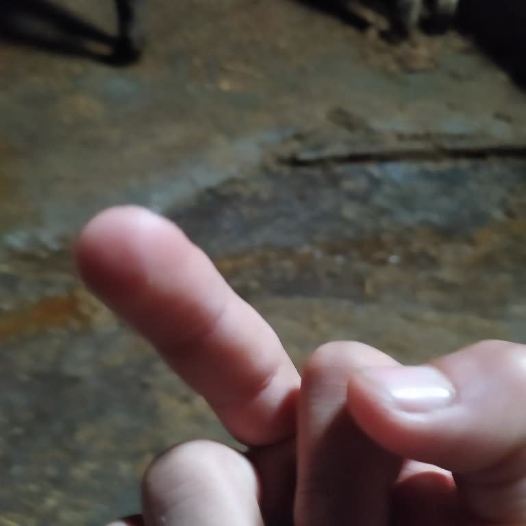 Yanıltıcı Ürün Tanıtımı Ve Sivilce Sorunu