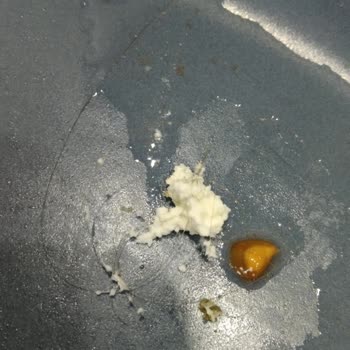 Süzme Peynirden Çıkan Siyah Saç Şoku