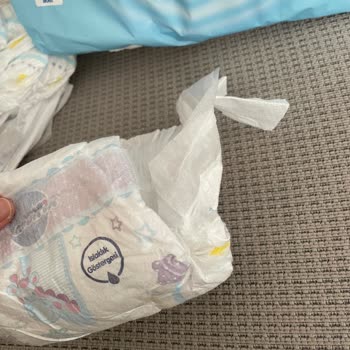 Molfix Bebek Bezlerinde Hayal Kırıklığı: Eksik Bantlar Ve Kullanılamayan Bezler