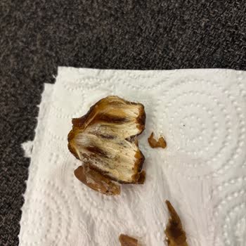 Kurtlu Hurmalar Ve İlgisiz Müşteri Hizmetleri