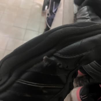 Adidas Ayakkabıda Beklenmedik Deri Açılması