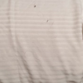 Afyon Özgül Termal'de Hijyen Sorunu Ve Yetersiz Hizmet