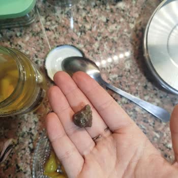 Acı Biber Turşusundan Taş Çıktı, Sağlık Riski!