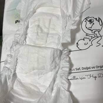 Defolu Bebek Bezleri Ve Yetersiz Müşteri Hizmeti