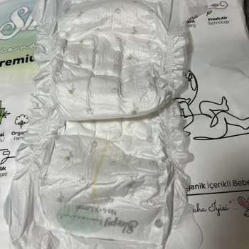 Defolu Bebek Bezleri Ve Yetersiz Müşteri Hizmeti